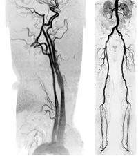 心臓・血管系(循環器内科・心臓血管外科領域)